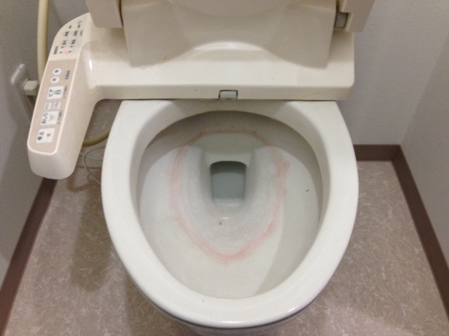 清掃内容：ハウスクリーニング　トイレの便器